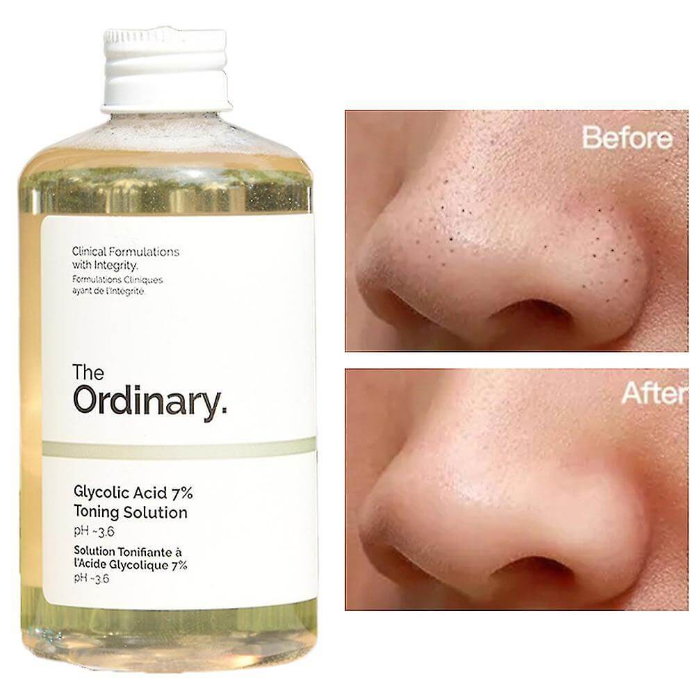 The Ordinary Glycolic Acid 7% Exfoliating Toner 240ml – AHA Toning Solution for Brighter, Smoother Skin
