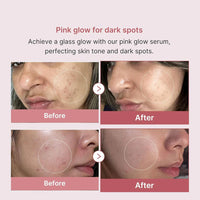 Medicube PDRN Pink Peptide Serum, Niacinamide, Hydrating, Korean Skincare