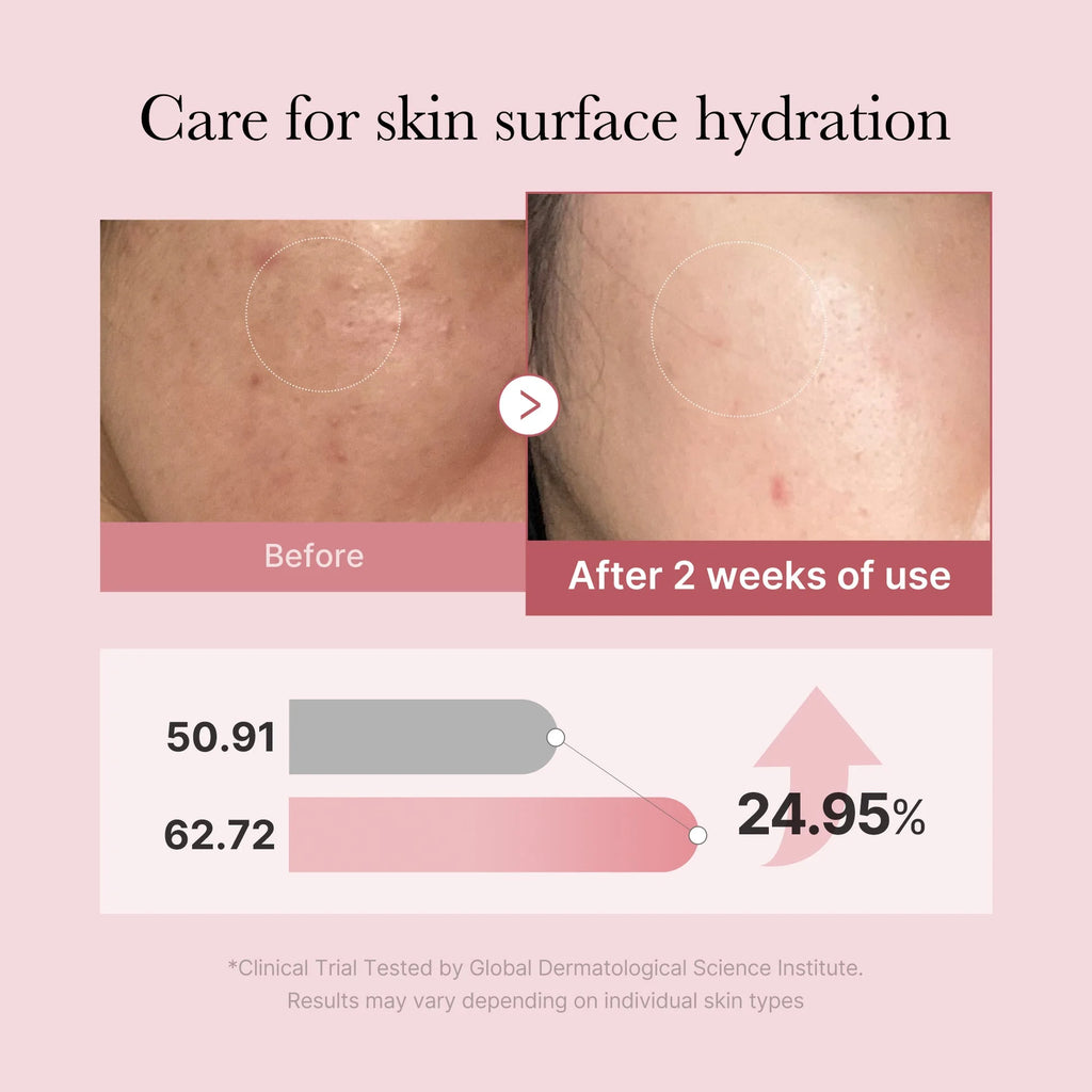Medicube PDRN Pink Peptide Serum, Niacinamide, Hydrating, Korean Skincare